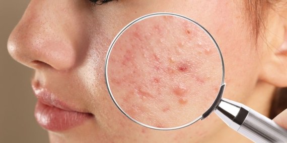 Sivilcelerden Kurtulmanın Yolları 2024